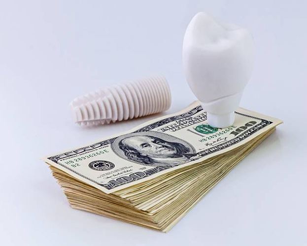 model and money representing the cost of dental implants in Williamsville