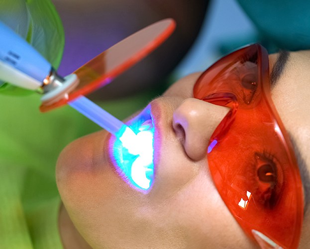 Dentist applying dental sealants