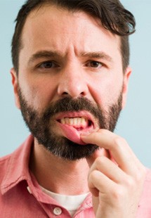 man pointing to inflamed gums 