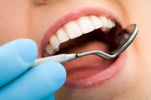 Prevent cavities with a dental cleaning in Williamsville, NY.