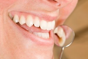 Your dentist in Williamsville helps to promote healthy gums.