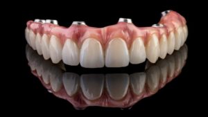 implant dentures that won’t get cavities