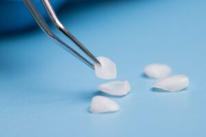 five veneers on a blue surface with tweezers 